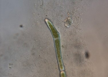 Algae